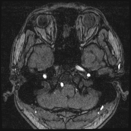 Click on the Serie image to view the images of VILLANUEVA, WILLIAM A.